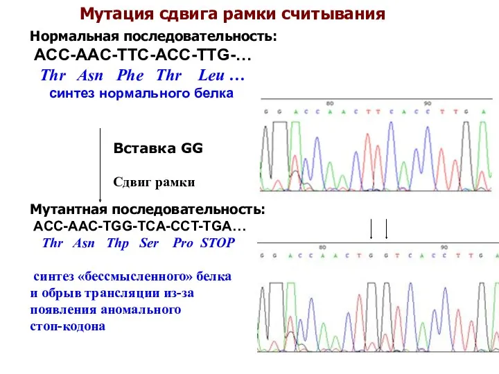 Мутация сдвига рамки считывания Нормальная последовательность: ACC-AAC-TTC-ACC-TTG-… Thr Asn Phe