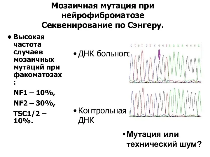 Мозаичная мутация при нейрофиброматозе Секвенирование по Сэнгеру. ДНК больного Контрольная