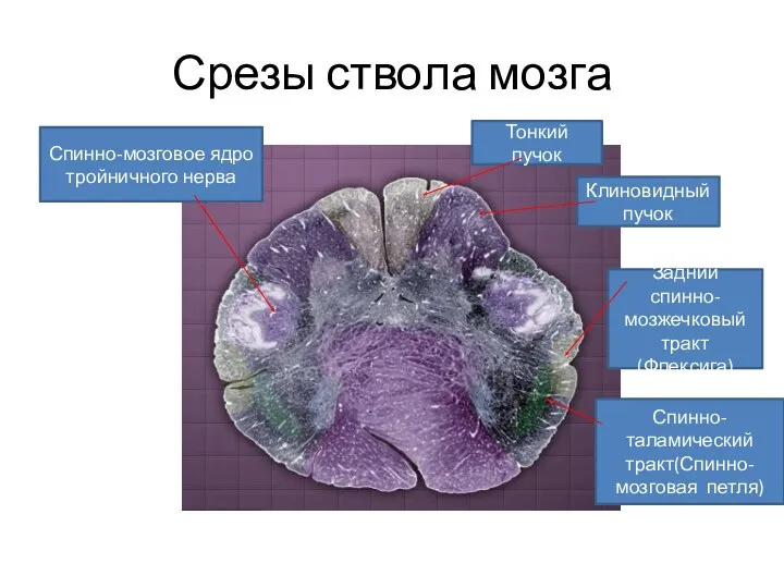 Срезы ствола мозга Спинно-мозговое ядро тройничного нерва Тонкий пучок Клиновидный