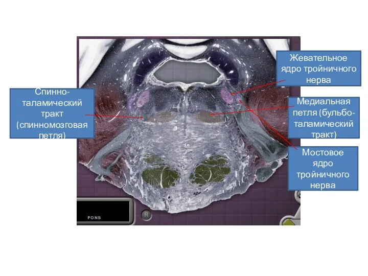 Жевательное ядро тройничного нерва Медиальная петля (бульбо-таламический тракт) Спинно-таламический тракт (спинномозговая петля) Мостовое ядро тройничного нерва