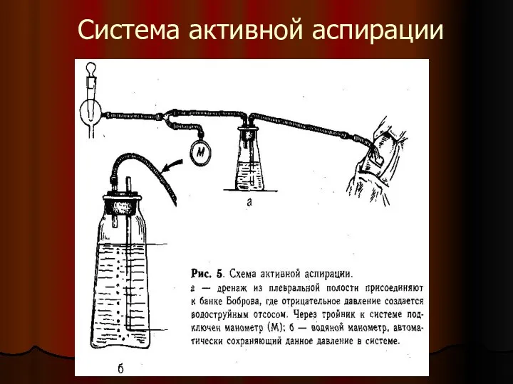 Система активной аспирации