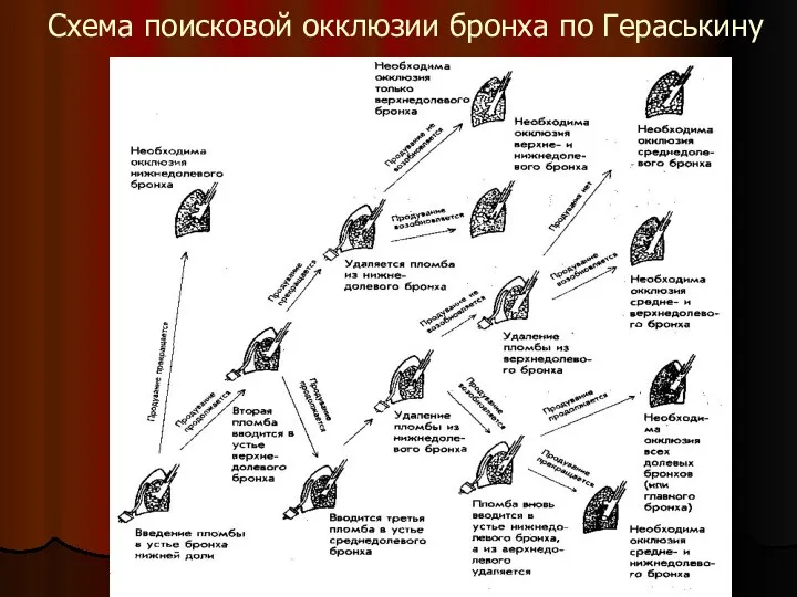 Схема поисковой окклюзии бронха по Гераськину