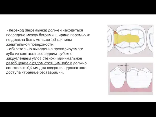 - переход (перемычка) должен находиться посредине между буграми, ширина перемычки