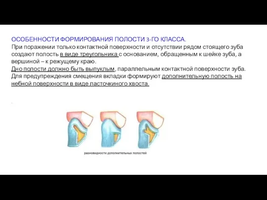 ОСОБЕННОСТИ ФОРМИРОВАНИЯ ПОЛОСТИ 3-ГО КЛАССА. При поражении только контактной поверхности и отсутствии рядом