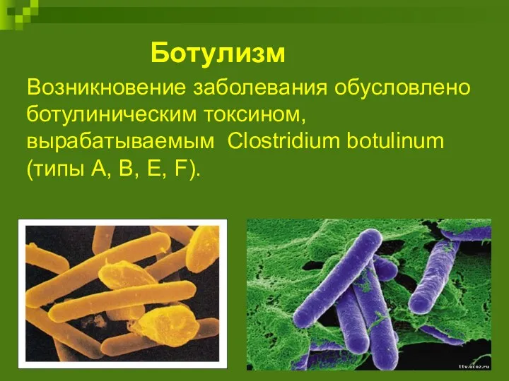 Ботулизм Возникновение заболевания обусловлено ботулиническим токсином, вырабатываемым Сlostridium botulinum (типы А, В, E, F).