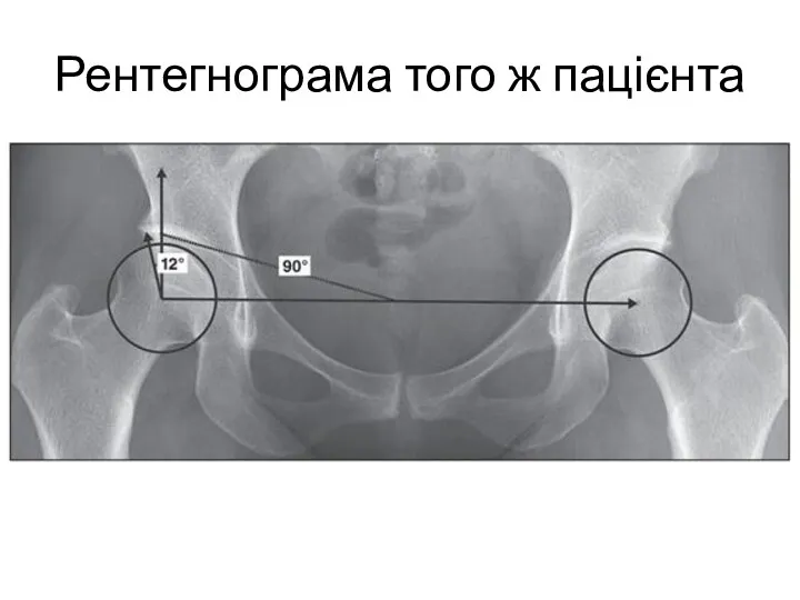 Рентегнограма того ж пацієнта