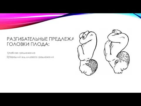 РАЗГИБАТЕЛЬНЫЕ ПРЕДЛЕЖАНИЯ ГОЛОВКИ ПЛОДА: 1)Лобное предлежание 2)Передний вид лицевого предлежания