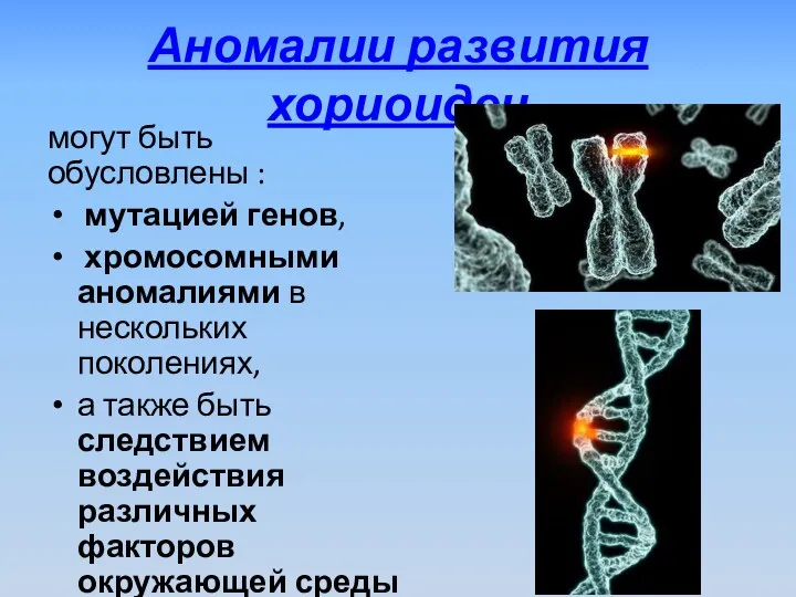 Аномалии развития хориоидеи могут быть обусловлены : мутацией генов, хромосомными