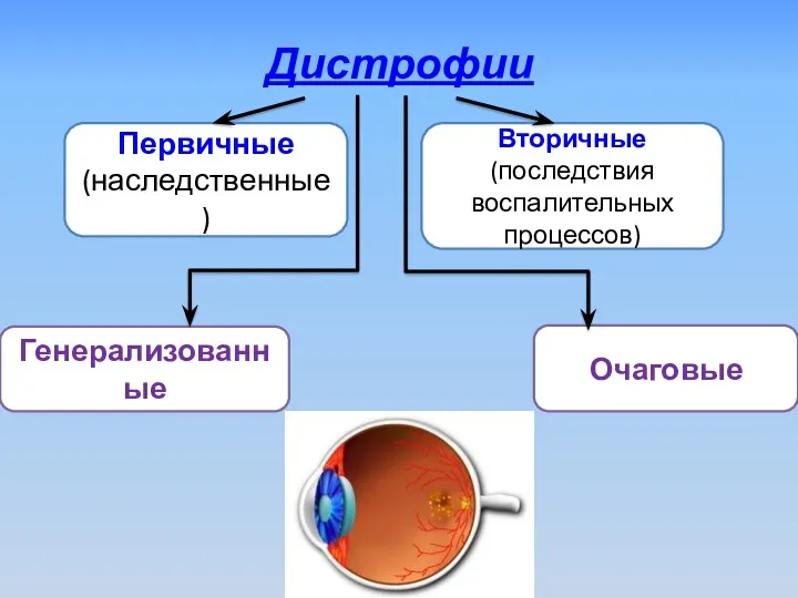 Дистрофии Первичные (наследственные) Вторичные (последствия воспалительных процессов) Генерализованные Очаговые