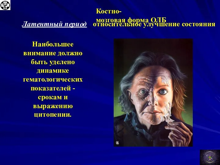 Костно-мозговая форма ОЛБ Латентный период - относительное улучшение состояния .