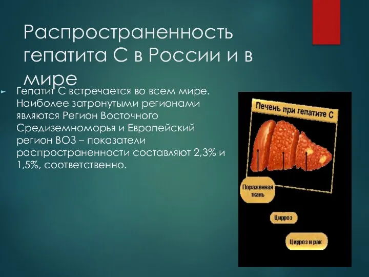 Распространенность гепатита С в России и в мире Гепатит С