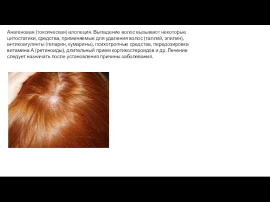 Анагеновая (токсическая) алопеция. Выпадение волос вызывают некоторые цитостатики, средства, применяемые для удаления волос