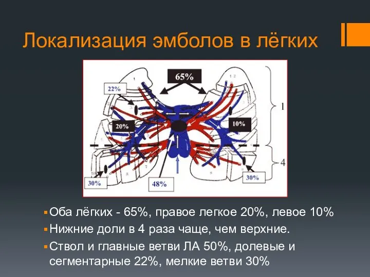 Локализация эмболов в лёгких Оба лёгких - 65%, правое легкое 20%, левое 10%