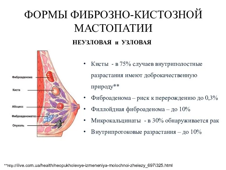 ФОРМЫ ФИБРОЗНО-КИСТОЗНОЙ МАСТОПАТИИ НЕУЗЛОВАЯ и УЗЛОВАЯ Кисты - в 75%