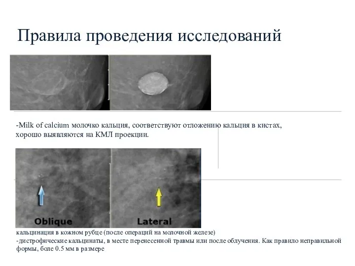 Правила проведения исследований -Milk of calcium молочко кальция, соответствуют отложению