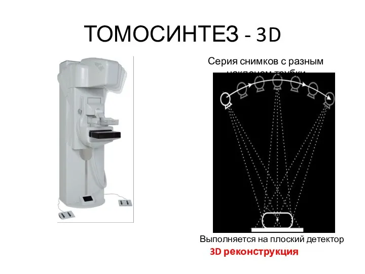 ТОМОСИНТЕЗ - 3D Серия снимков с разным наклоном трубки 3D реконструкция Выполняется на плоский детектор