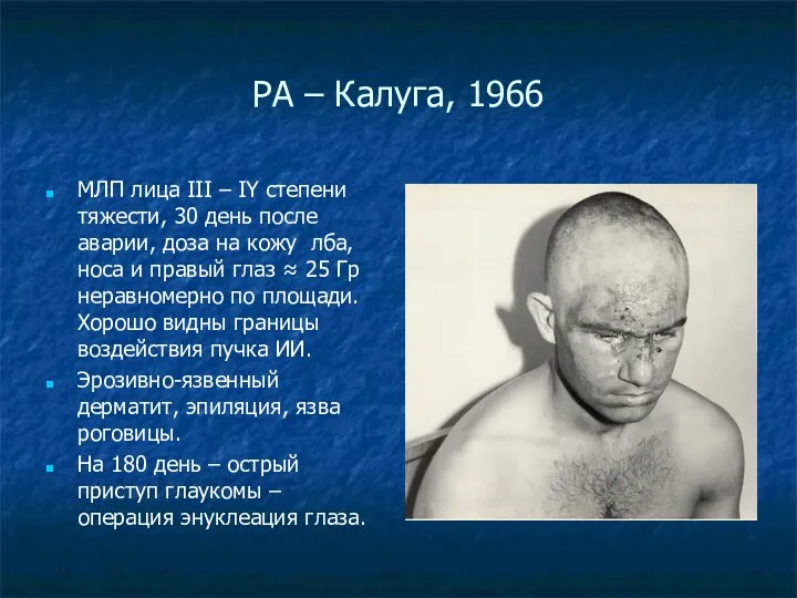РА – Калуга, 1966 МЛП лица III – IY степени тяжести, 30 день