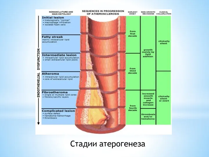 Стадии атерогенеза