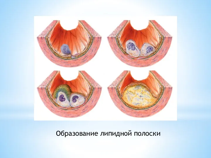 Образование липидной полоски