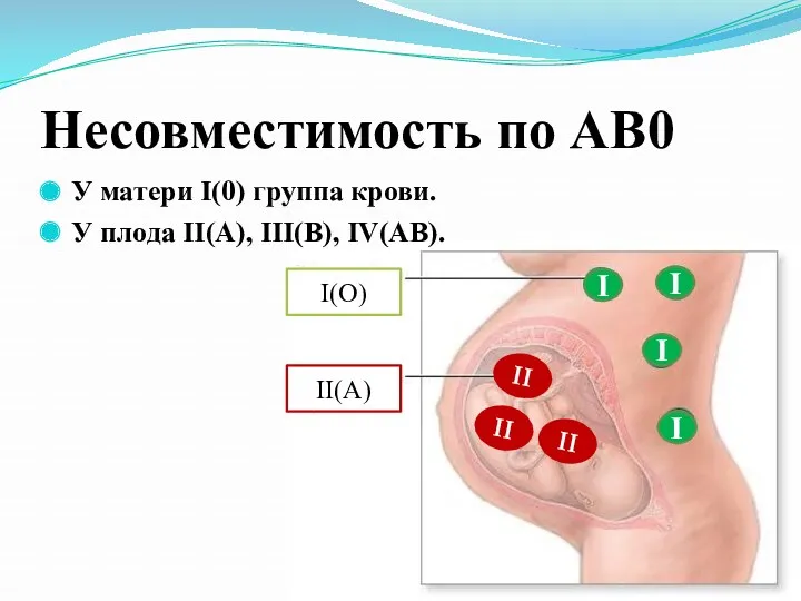 Несовместимость по АВ0 У матери I(0) группа крови. У плода