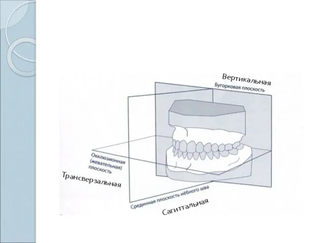 Вертикальная Сагиттальная Трансверзальная