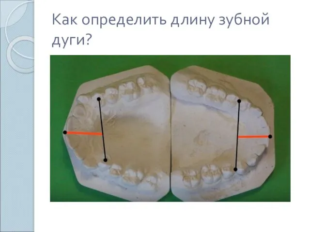 Как определить длину зубной дуги?