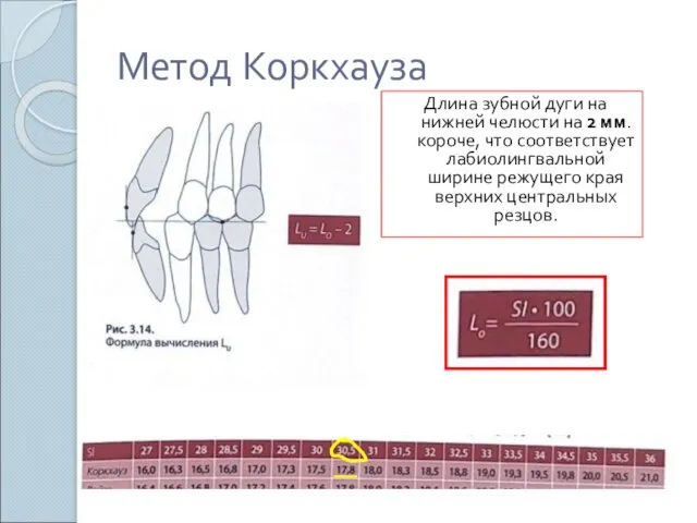 Метод Коркхауза Длина зубной дуги на нижней челюсти на 2
