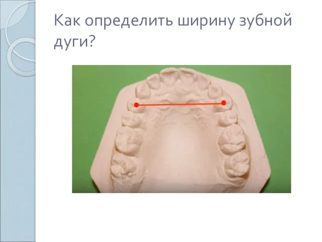 Как определить ширину зубной дуги?