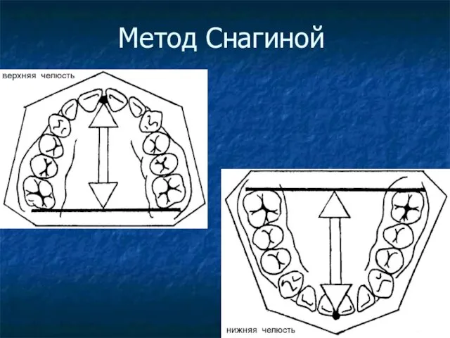 Метод Снагиной