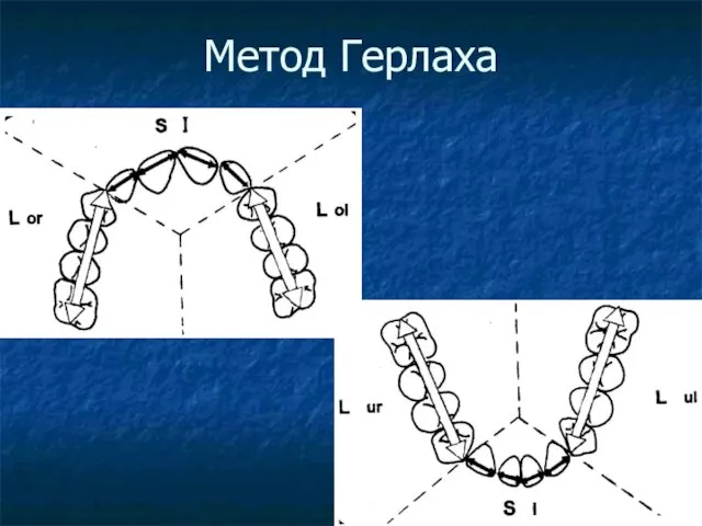 Метод Герлаха