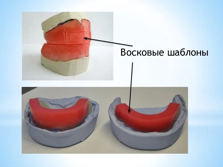 Восковые шаблоны