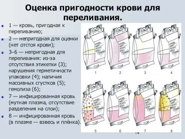 Оценка пригодности крови для переливания. 1 — кровь, пригодная к