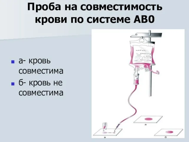 Проба на совместимость крови по системе АВ0 а- кровь совместима б- кровь не совместима