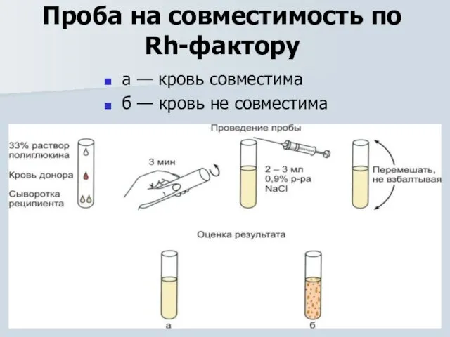 Проба на совместимость по Rh-фактору а — кровь совместима б — кровь не совместима