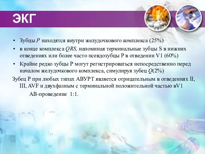 ЭКГ Зубцы Р находятся внутри желудочкового комплекса (25%) в конце