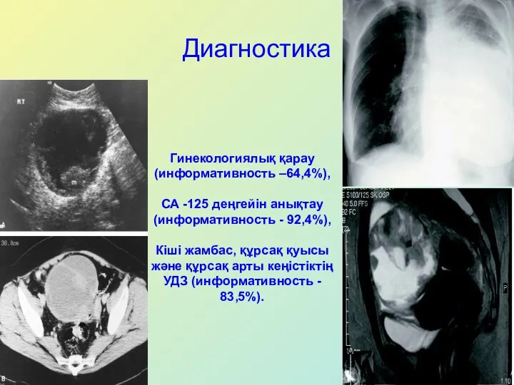 Диагностика Гинекологиялық қарау (информативность –64,4%), СА -125 деңгейін анықтау (информативность