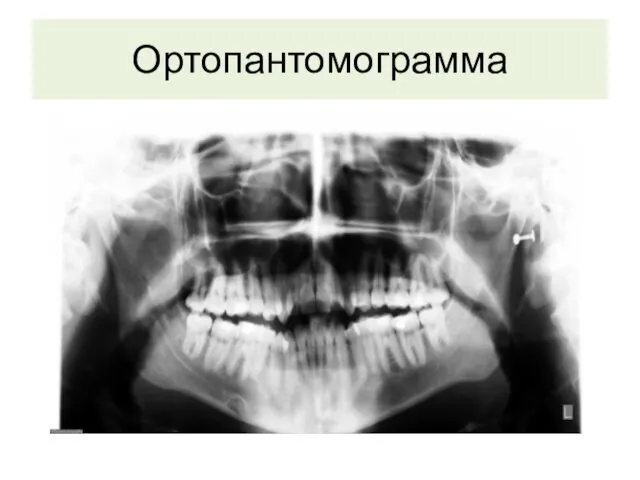 Ортопантомограмма
