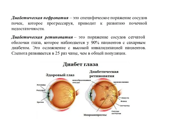 Диабетическая нефропатия – это специфическое поражение сосудов почек, которое прогрессируя,