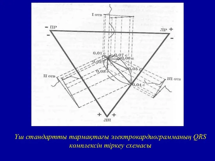 Үш стандартты тармақтағы электрокардиограмманың QRS комплексін тіркеу схемасы