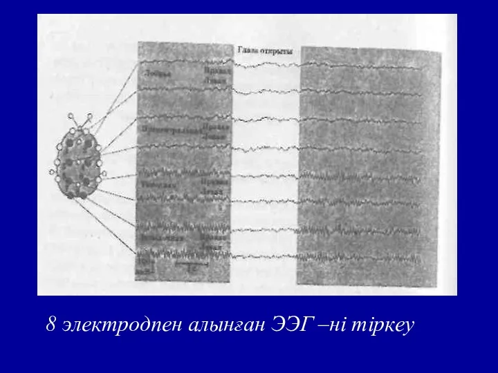 8 электродпен алынған ЭЭГ –ні тіркеу