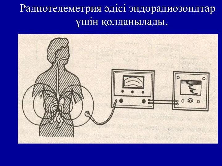 Радиотелеметрия әдісі эндорадиозондтар үшін қолданылады.