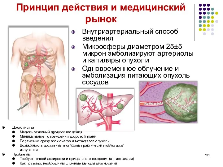 Принцип действия и медицинский рынок Внутриартериальный способ введения Микросферы диаметром