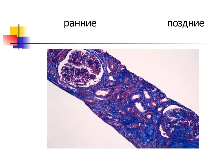 ранние поздние