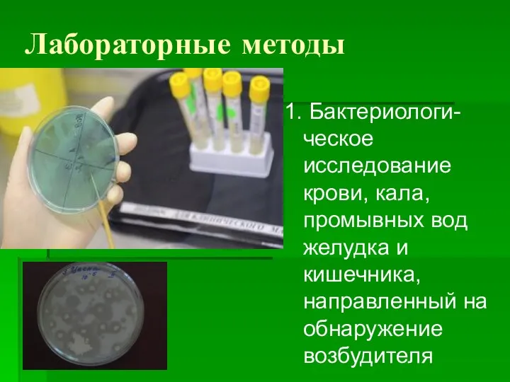 Лабораторные методы 1. Бактериологи-ческое исследование крови, кала, промывных вод желудка и кишечника, направленный на обнаружение возбудителя