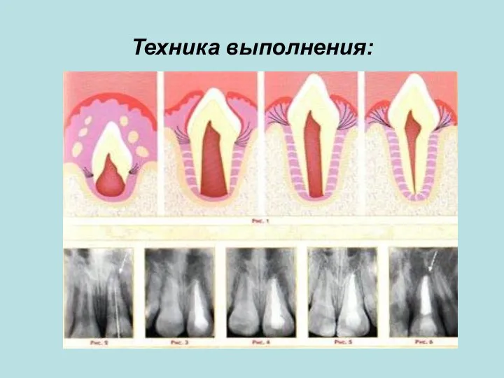 Техника выполнения: