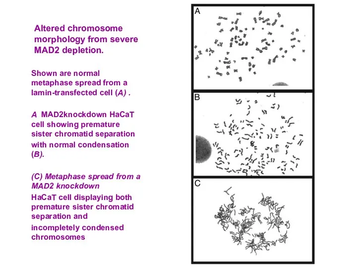 Altered chromosome morphology from severe MAD2 depletion. Shown are normal