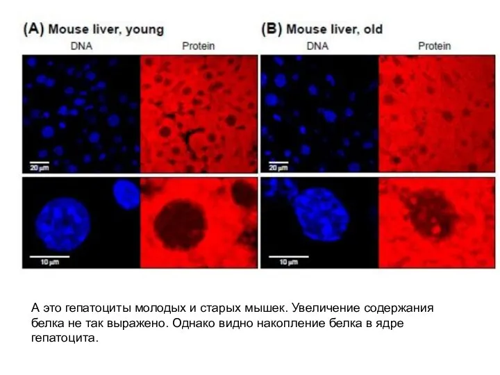 А это гепатоциты молодых и старых мышек. Увеличение содержания белка не так выражено.