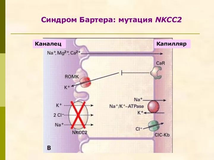 Синдром Бартера: мутация NKCC2 Капилляр Каналец