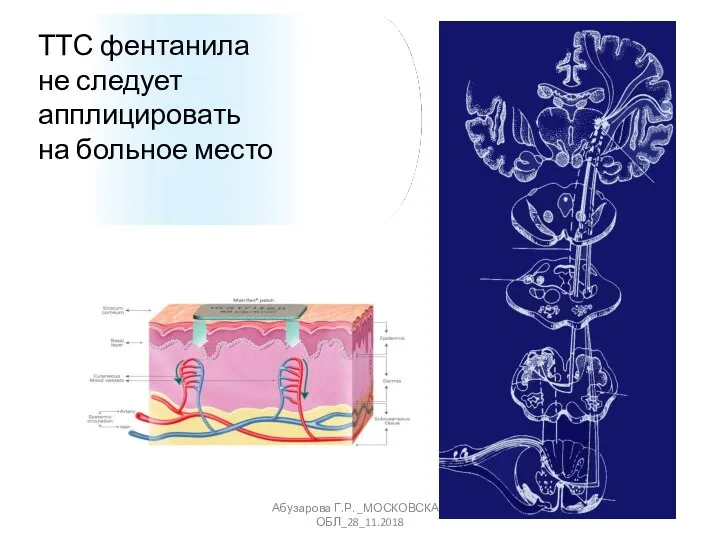 Абузарова Г.Р. _МОСКОВСКАЯ ОБЛ_28_11.2018 ТТС фентанила не следует апплицировать на больное место