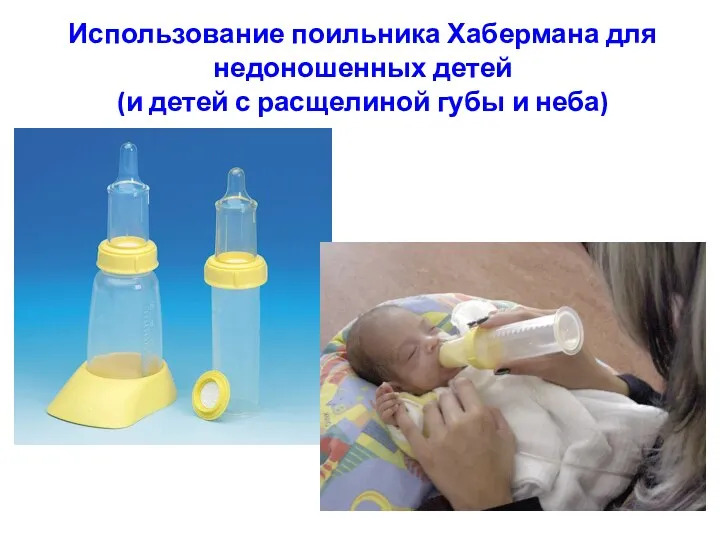 Использование поильника Хабермана для недоношенных детей (и детей с расщелиной губы и неба)
